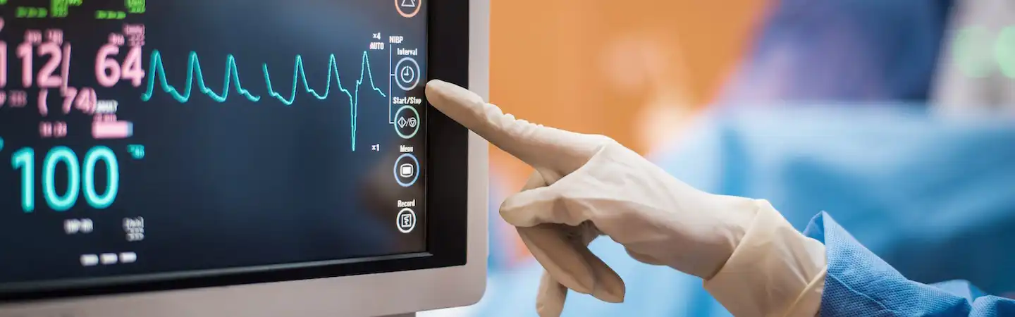 Gloved hand pointing at a heart rate monitor displaying vital signs and a heart rate in a medical setting.