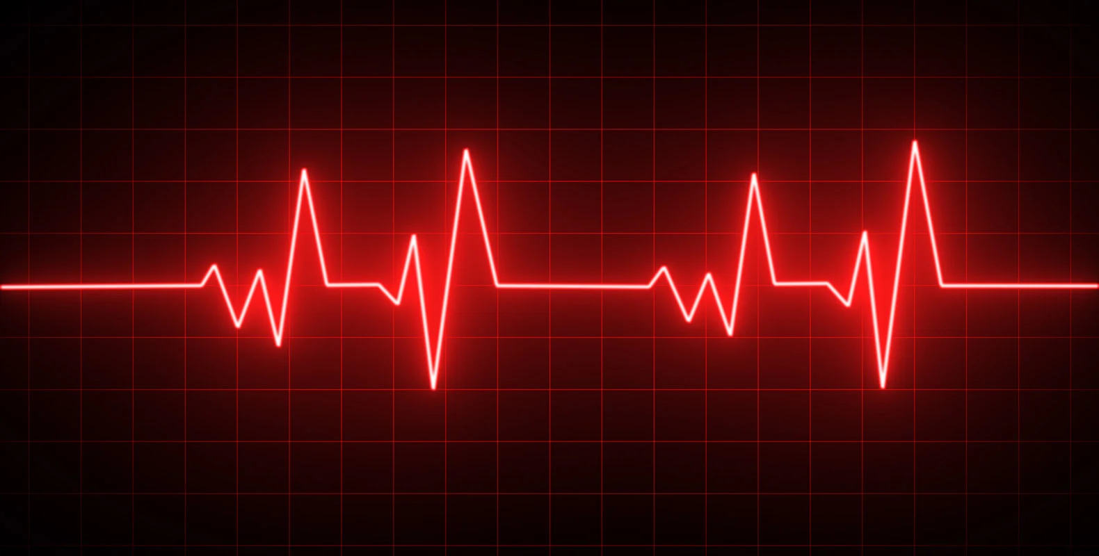 Red electrocardiogram (ECG) line displaying heartbeats on a black background with a grid pattern.